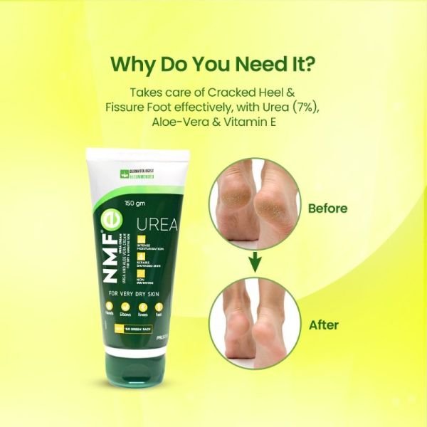 nmf e urea cream moisturizer
